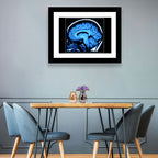 Sagittal Brain Mri Scan in Blue Wall Art