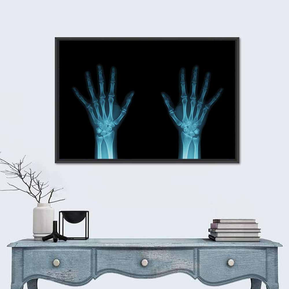 Blue X-ray Hands Wall Art