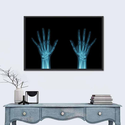 Blue X-ray Hands Wall Art