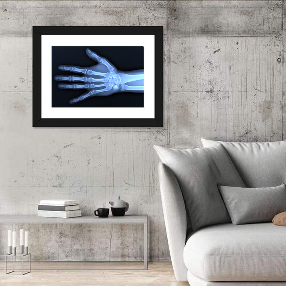 Blue Hand Radiograph Wall Art