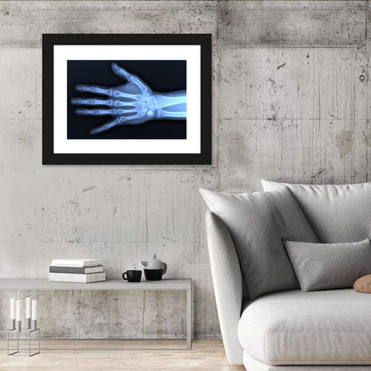 Blue Hand Radiograph Wall Art