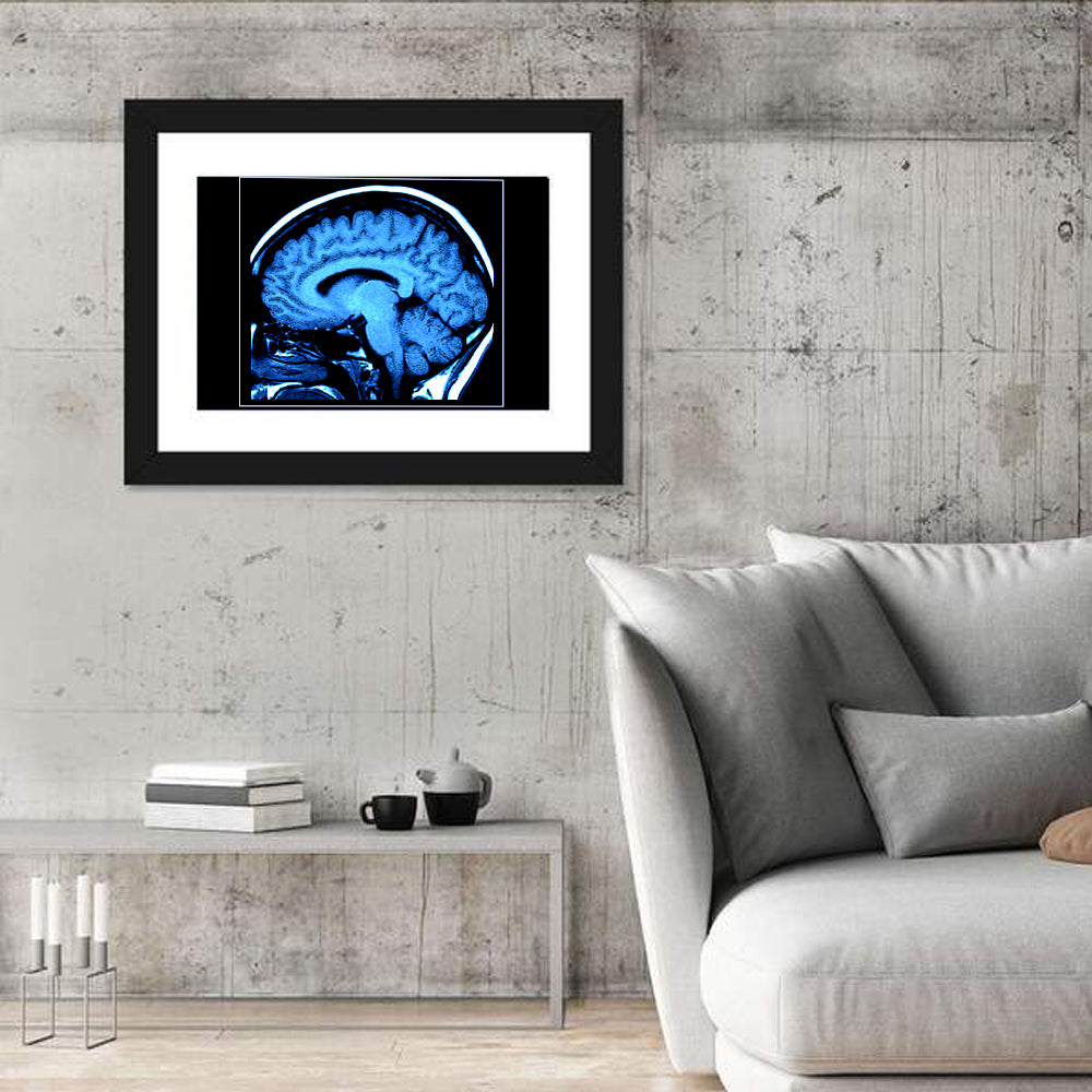Sagittal Brain Mri Scan in Blue Wall Art in a room, landscape