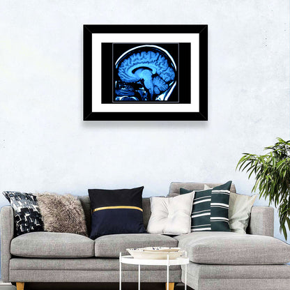 Human Brain MRI Wall Art