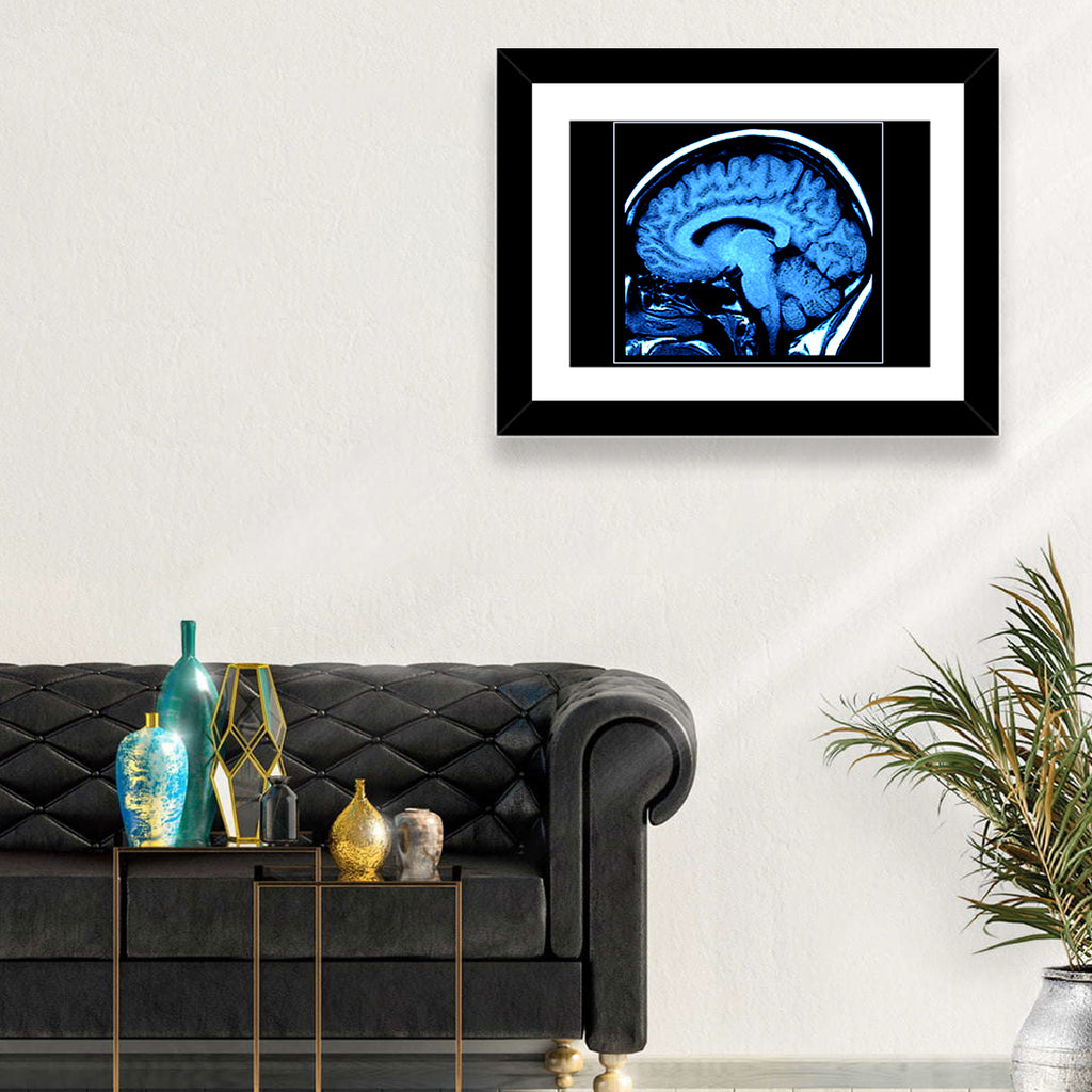Sagittal Brain Mri Scan in Blue Wall Art