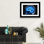 Sagittal Brain Mri Scan in Blue Wall Art