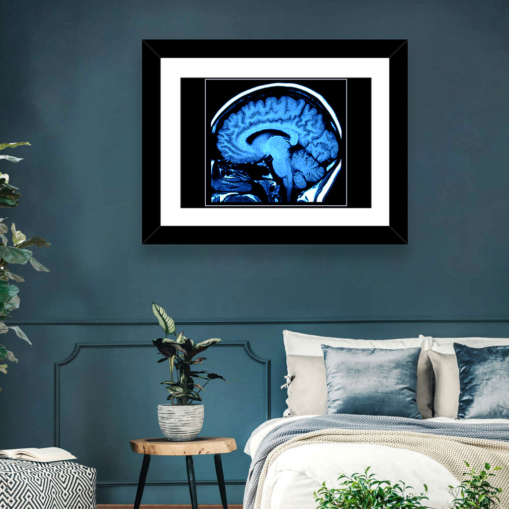 Sagittal Brain Mri Scan in Blue Wall Art