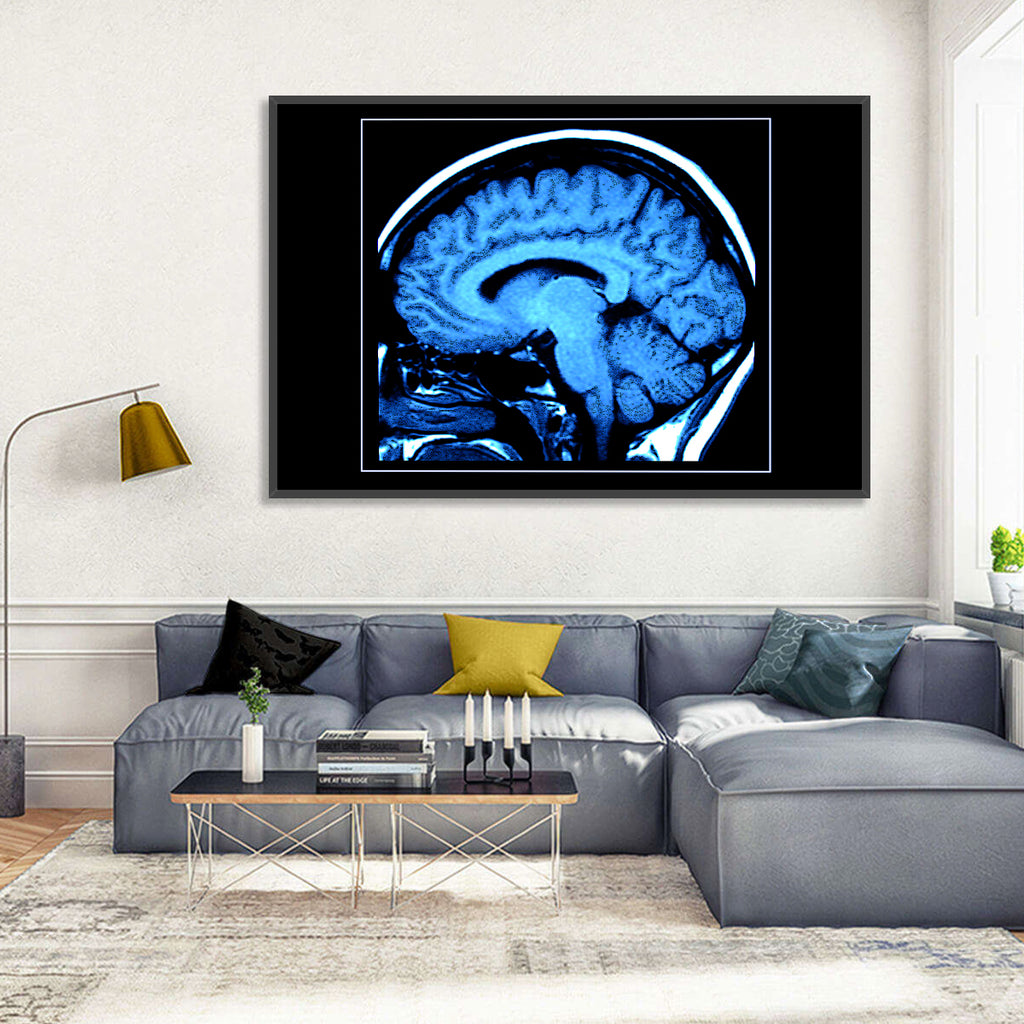 Sagittal Brain Mri Scan in Blue Wall Art