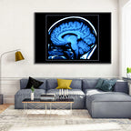 Sagittal Brain Mri Scan in Blue Wall Art