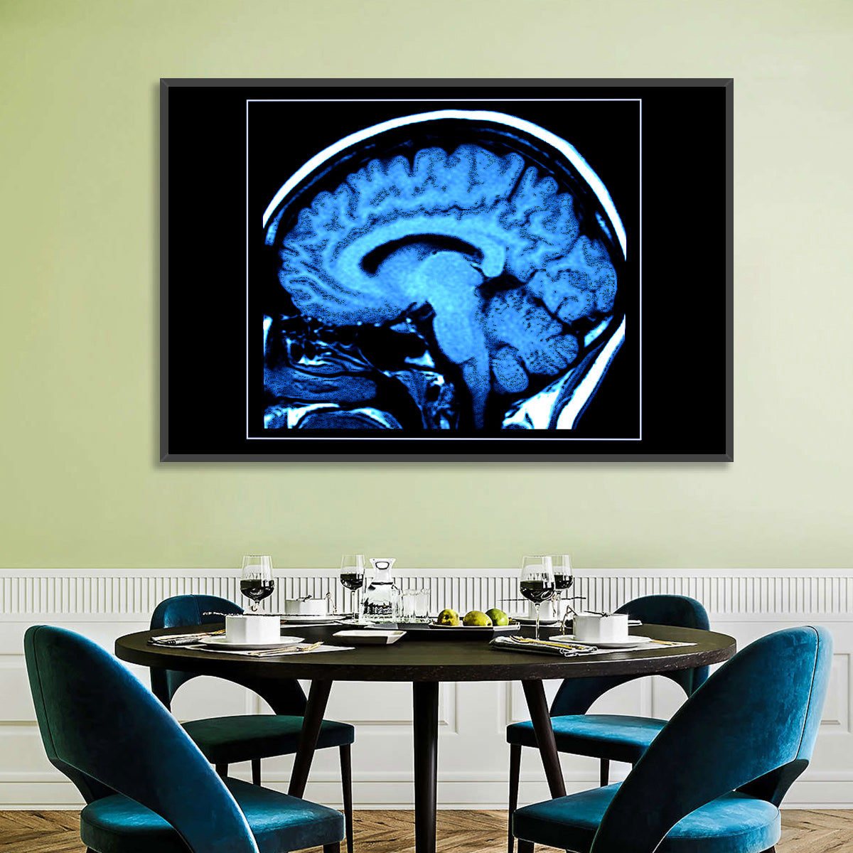 Sagittal Brain Mri Scan in Blue Wall Art in a room, landscape