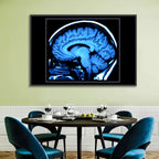 Sagittal Brain Mri Scan in Blue Wall Art