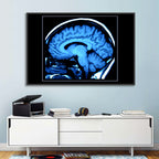 Sagittal Brain Mri Scan in Blue Wall Art