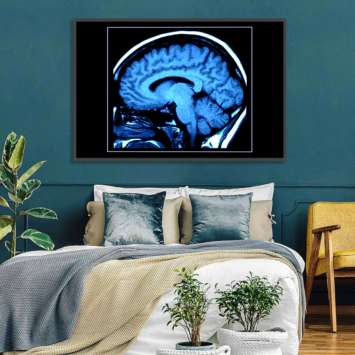 Sagittal Brain Mri Scan in Blue Wall Art in a room, landscape
