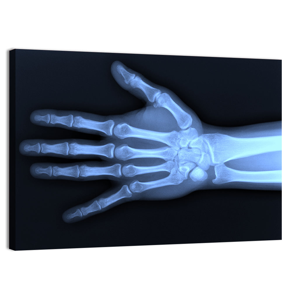 Blue Hand Radiograph Wall Art