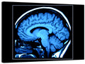 Sagittal Brain Mri Scan in Blue Wall Art