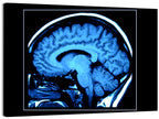 Sagittal Brain Mri Scan in Blue Wall Art