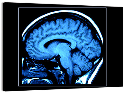 Human Brain MRI Wall Art