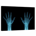 Blue X-ray Hands Wall Art
