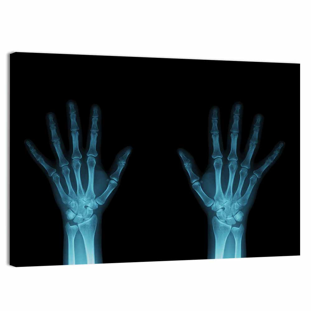 Blue X-ray Hands Wall Art