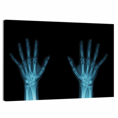 Blue X-ray Hands Wall Art