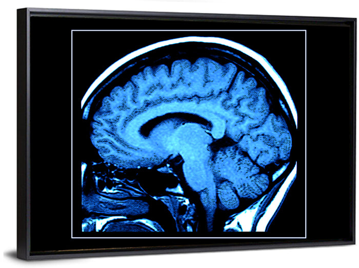 Sagittal Brain Mri Scan in Blue Wall Art as a framed canvas
