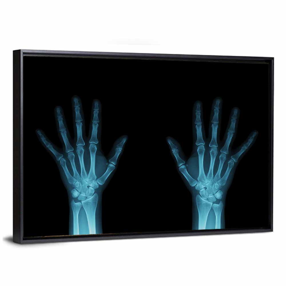 Blue X-ray Hands Wall Art