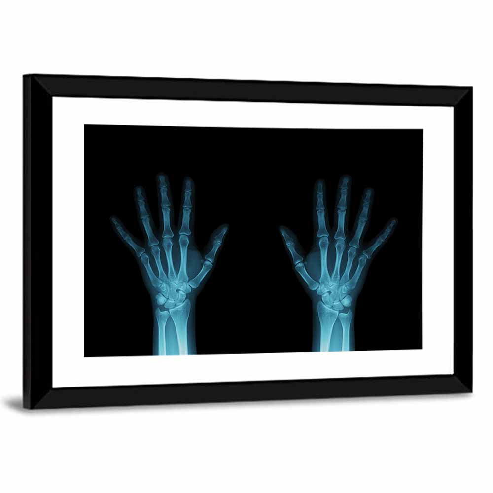 Blue X-ray Hands Wall Art
