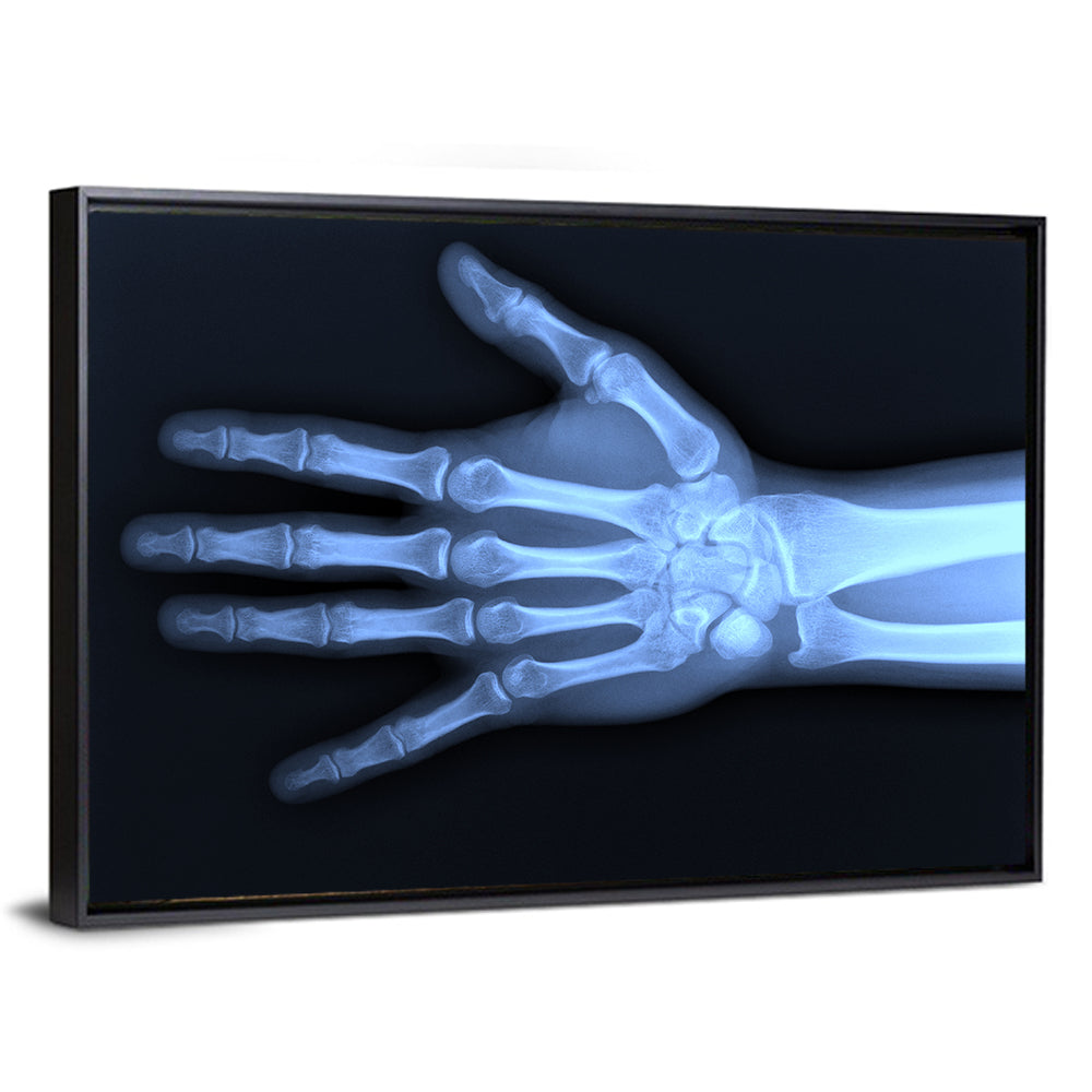 Blue Hand Radiograph Wall Art