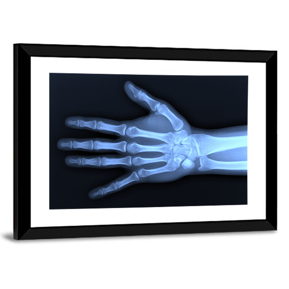 Blue Hand Radiograph Wall Art