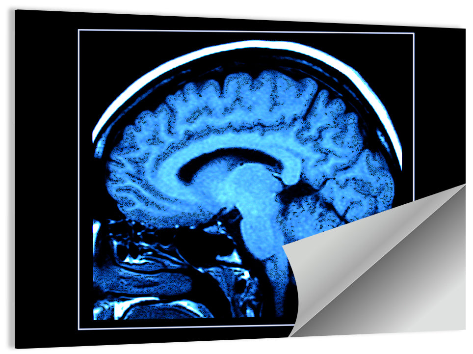Sagittal Brain Mri Scan in Blue Wall Art