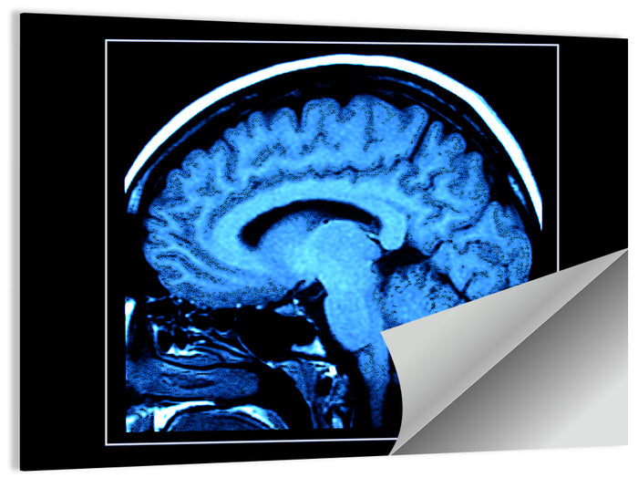 Sagittal Brain Mri Scan in Blue Wall Art as a poster print