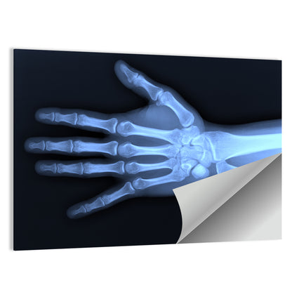 Blue Hand Radiograph Wall Art