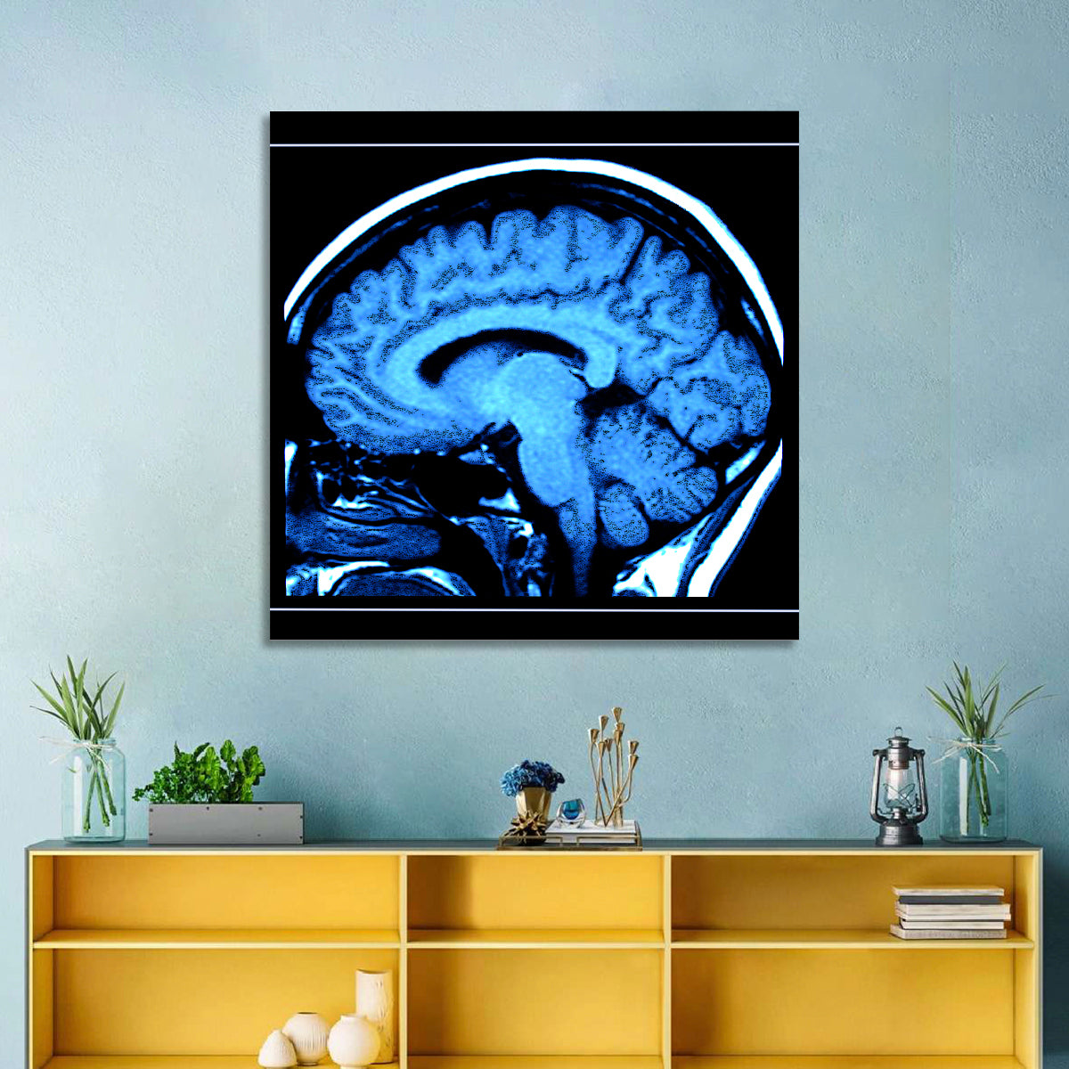 Sagittal Brain Mri Scan in Blue Wall Art