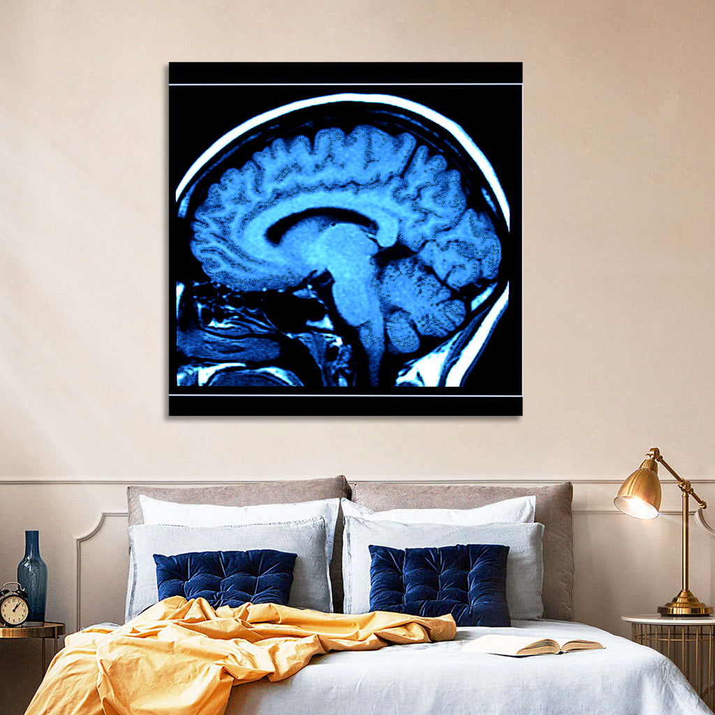 Sagittal Brain Mri Scan in Blue Wall Art