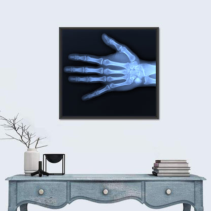 Blue Hand Radiograph Wall Art