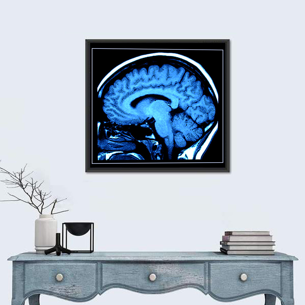 Sagittal Brain Mri Scan in Blue Wall Art