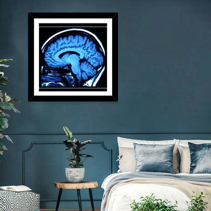 Human Brain MRI Wall Art