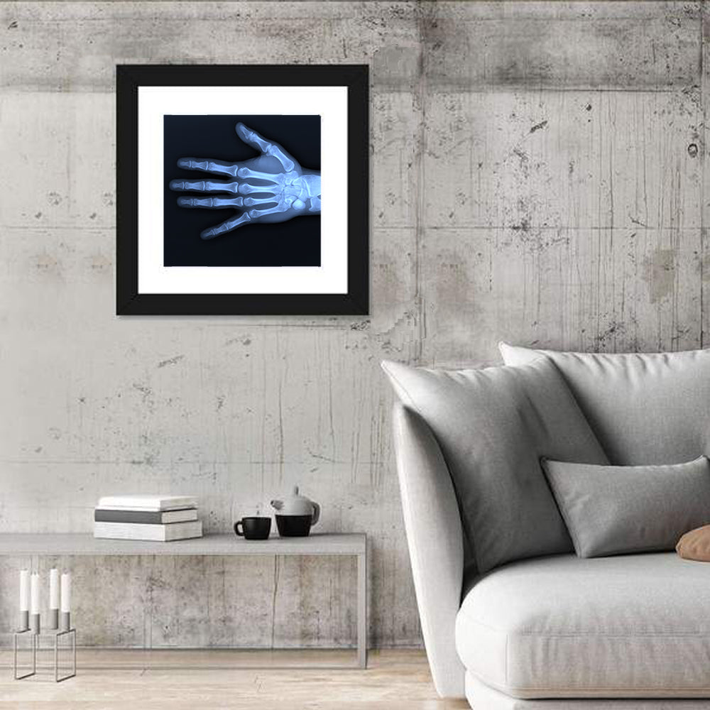 Blue Hand Radiograph Wall Art