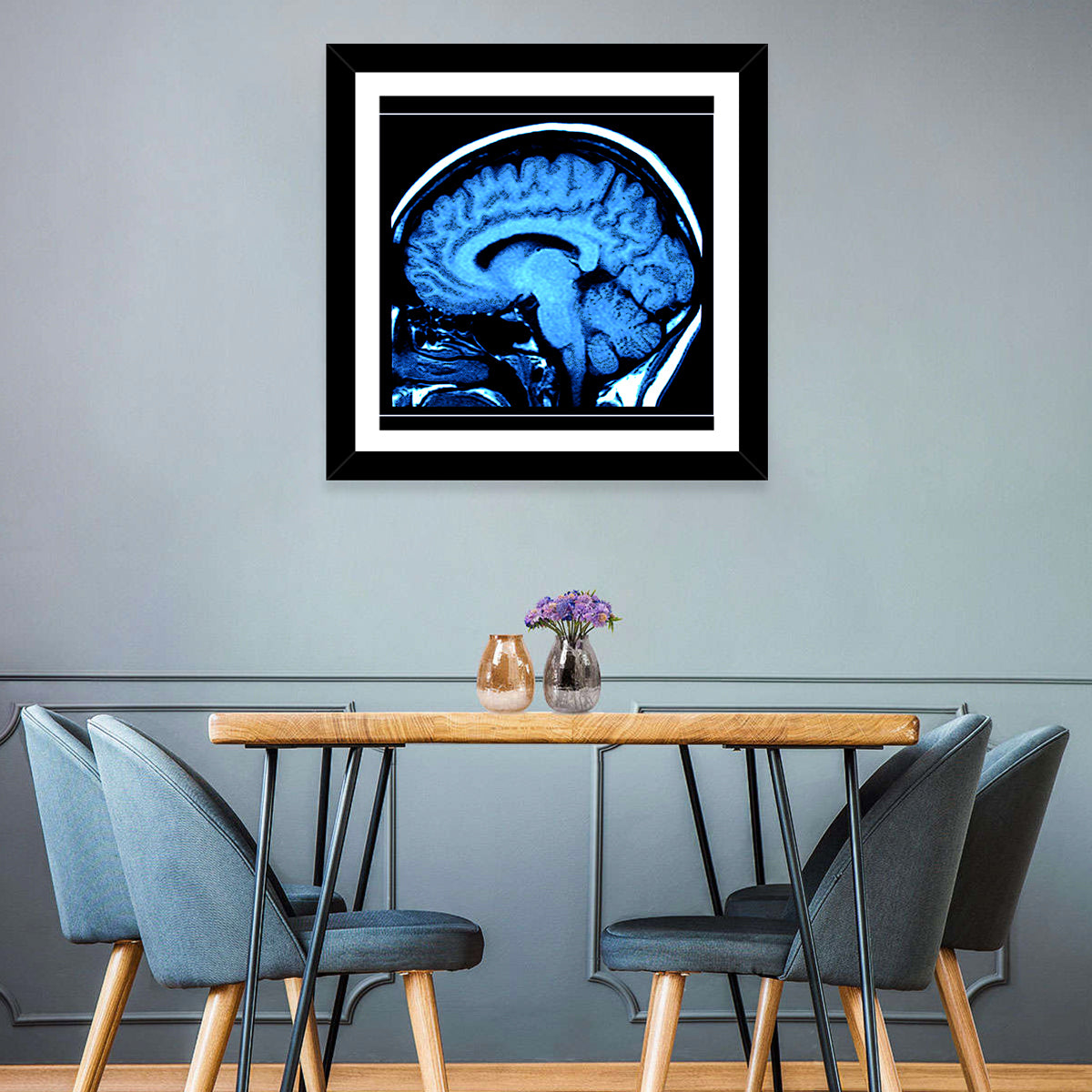 Sagittal Brain Mri Scan in Blue Wall Art