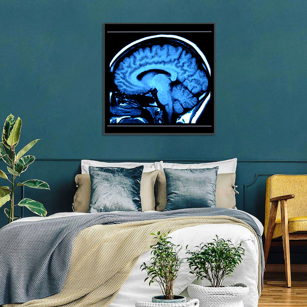 Human Brain MRI Wall Art