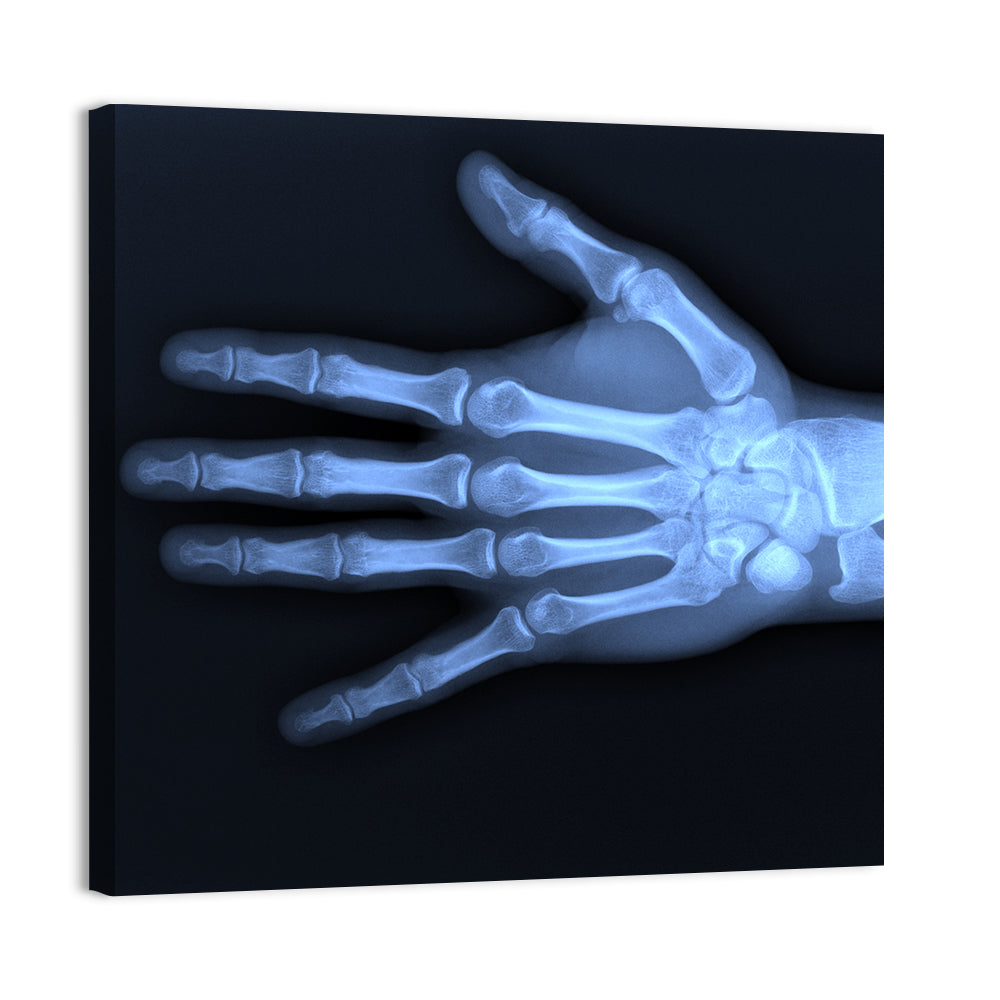 Blue Hand Radiograph Wall Art