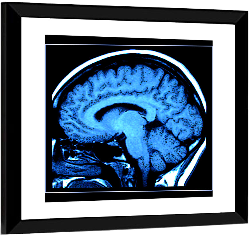 Sagittal Brain Mri Scan in Blue Wall Art