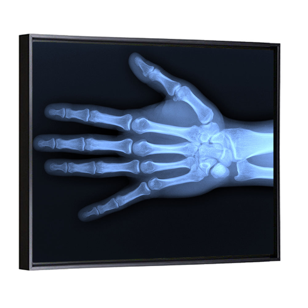 Blue Hand Radiograph Wall Art