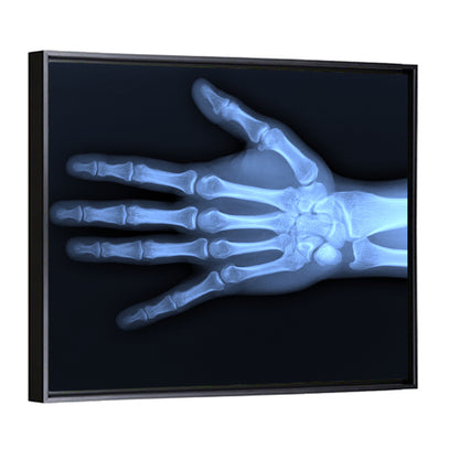 Blue Hand Radiograph Wall Art