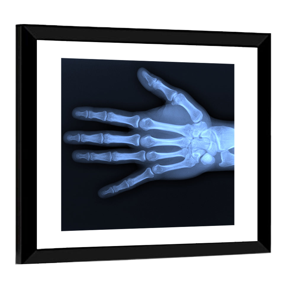 Blue Hand Radiograph Wall Art