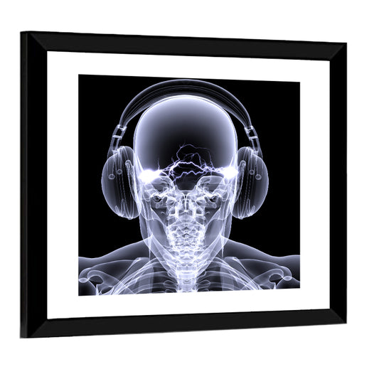 X-ray Skull with Headphones Wall Art