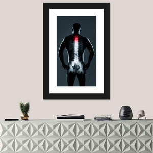 Human Spine X-Ray Wall Art