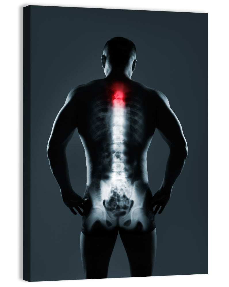 Human Spine X-ray Wall Art