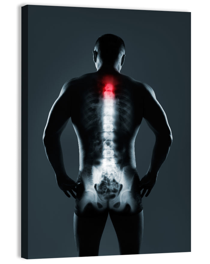 Human Spine X-ray Wall Art as a canvas print