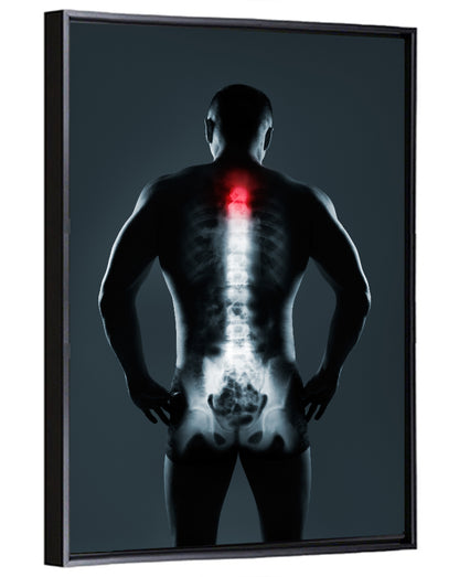 Human Spine X-ray Wall Art