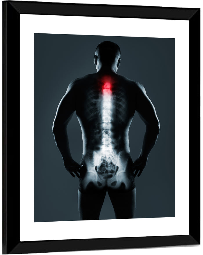 Human Spine X-ray Wall Art as a framed print